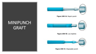 MINIPUNCH
GRAFT
 