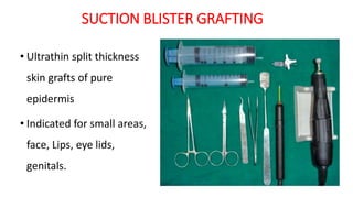 MINIPUNCH
GRAFT
SUCTION BLISTER GRAFTING
• Ultrathin split thickness
skin grafts of pure
epidermis
• Indicated for small areas,
face, Lips, eye lids,
genitals.
 