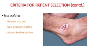 CRITERIA FOR PATIENT SELECTION (contd.)
• Test grafting
- No new patches
- Non-expanding patch
- Absent koebnerization
 
