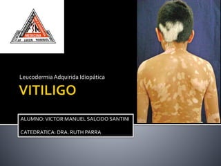 Leucodermia Adquirida Idiopática
ALUMNO:VICTOR MANUEL SALCIDO SANTINI
CATEDRATICA: DRA. RUTH PARRA
 