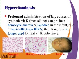 88
HypervitaminosisHypervitaminosis
 Prolonged administration of large doses of
synthetic vit K (menadione) can produce
hemolytic anemiahemolytic anemia & jaundicejaundice in the infant, due
to toxic effects on RBCstoxic effects on RBCs; therefore, it is nono
longer usedlonger used to treat vit K deficiency.
Normal Hemolytic anemia Jaundice
 