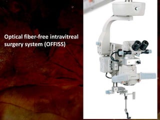 Vitrectomy Systems Vitrectomy | PPTX