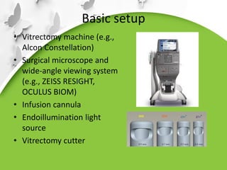 Vitrectomy Systems eye evaluation Vitrectomy - Anterior segment.pdf