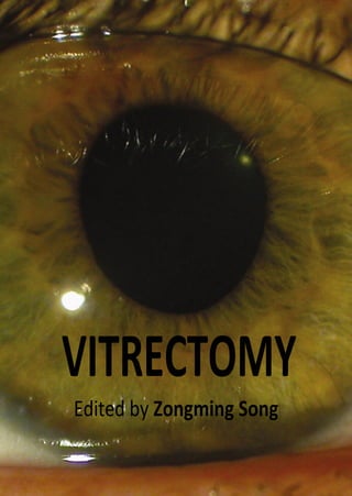 VITRECTOMY
Edited by Zongming Song
 