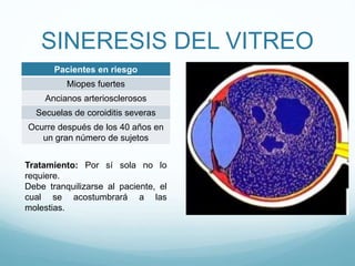 SINERESIS DEL VITREO
Pacientes en riesgo
Miopes fuertes
Ancianos arteriosclerosos
Secuelas de coroiditis severas
Ocurre después de los 40 años en
un gran número de sujetos
Tratamiento: Por sí sola no lo
requiere.
Debe tranquilizarse al paciente, el
cual se acostumbrará a las
molestias.

 
