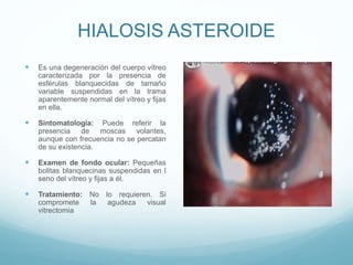 HIALOSIS ASTEROIDE


Es una degeneración del cuerpo vítreo
caracterizada por la presencia de
esférulas blanquecidas de tamaño
variable suspendidas en la trama
aparentemente normal del vítreo y fijas
en ella.



Sintomatología: Puede referir la
presencia de moscas volantes,
aunque con frecuencia no se percatan
de su existencia.



Examen de fondo ocular: Pequeñas
bolitas blanquecinas suspendidas en l
seno del vítreo y fijas a él.



Tratamiento: No lo requieren. Si
compromete
la
agudeza
visual
vitrectomia

 