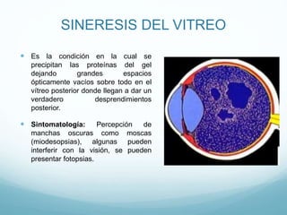 SINERESIS DEL VITREO
 Es la condición en la cual se
precipitan las proteínas del gel
dejando
grandes
espacios
ópticamente vacíos sobre todo en el
vítreo posterior donde llegan a dar un
verdadero
desprendimientos
posterior.

 Sintomatología:

Percepción
de
manchas oscuras como moscas
(miodesopsias), algunas pueden
interferir con la visión, se pueden
presentar fotopsias.

 