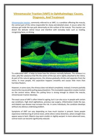 Vitreomacular Traction (VMT) In Ophthalmology Causes, Diagnosis, And ...