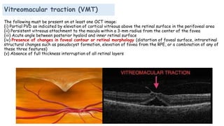 Vitreomacular traction (VMT)
The following must be present on at least one OCT image:
(i) Partial PVD as indicated by elevation of cortical vitreous above the retinal surface in the perifoveal area
(ii) Persistent vitreous attachment to the macula within a 3-mm radius from the center of the fovea
(iii) Acute angle between posterior hyaloid and inner retinal surface
(iv) Presence of changes in foveal contour or retinal morphology (distortion of foveal surface, intraretinal
structural changes such as pseudocyst formation, elevation of fovea from the RPE, or a combination of any of
these three features)
(v) Absence of full thickness interruption of all retinal layers
 