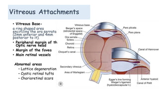 Vitreous Attachments
• Vitreous Base-
a ring shaped area
encircling the ora serrata
(2mm anterior and 4mm
posterior to it).
• Peripheral margin of the
Optic nerve head
• Margin of the fovea
• Main retinal vessels
Abnormal areas
– Lattice degeneration
– Cystic retinal tufts
– Chorioretinal scars
 