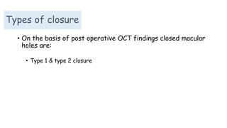 • On the basis of post operative OCT findings closed macular
holes are:
• Type 1 & type 2 closure
Types of closure
 