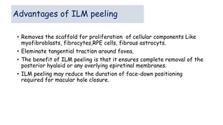 Advantages of ILM peeling
• Removes the scaffold for proliferation of cellular components Like
myofibroblasts, fibrocytes,RPE cells, fibrous astrocyts.
• Eleminate tangential traction around fovea.
• The benefit of ILM peeling is that it ensures complete removal of the
posterior hyaloid or any overlying epiretinal membranes.
• ILM peeling may reduce the duration of face-down positioning
required for macular hole closure.
 
