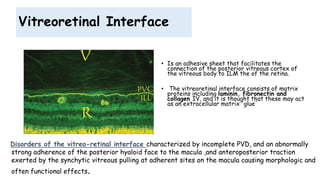 Vitreoretinal Interface
• Is an adhesive sheet that facilitates the
connection of the posterior vitreous cortex of
the vitreous body to ILM the of the retina.
• The vitreoretinal interface consists of matrix
proteins including laminin, fibronectin and
collagen IV, and it is thought that these may act
as an extracellular matrix 'glue'
Disorders of the vitreo-retinal interface characterized by incomplete PVD, and an abnormally
strong adherence of the posterior hyaloid face to the macula ,and anteroposterior traction
exerted by the synchytic vitreous pulling at adherent sites on the macula causing morphologic and
often functional effects.
 