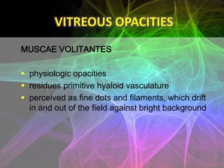 VITREOUS OPACITIES
INFLAMMATORY VITREOUS OPACITIES

 exudates poured into the vitreous in

   –   anterior uveitis (irido...