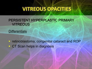 VITREOUS OPACITIES
AMYLOID DEGENERATION

 rare condition
 amorphous amyloid material is deposited in the
  vitreous
 pa...
