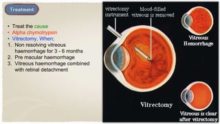 • Treat the cause
• Alpha chymotrypsin
• Vitrectomy, When;
1. Non resolving vitreous
haemorrhage for 3 - 6 months
2. Pre macular haemorrhage
3. Vitreous haemorrhage combined
with retinal detachment
 