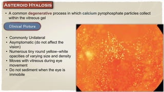 • A common degenerative process in which calcium pyrophosphate particles collect
within the vitreous gel
• Commonly Unilateral
• Asymptomatic (do not affect the
vision)
• Numerous tiny round yellow–white
opacities of varying size and density
• Moves with vitreous during eye
movement
• Do not sediment when the eye is
immobile
 