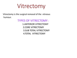 Vitrectomy Types vitreous Final .pptx