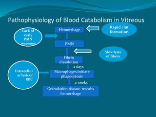 Pathophysiology of Blood Catabolism in Vitreous
Hemorrhage
PMN
Fibrin
dissolution
Macrophages initiate
phagocytosis
Granulation tisssue resorbs
hemorrhage
2 days
2 weeks
Lack of
early
PMN
response
Slow lysis
of fibrin
Extracellul
ar lysis of
RBC
Rapid clot
formation
 