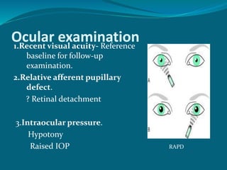 Ocular examination1.Recent visual acuity- Reference
baseline for follow-up
examination.
2.Relative afferent pupillary
defect.
? Retinal detachment
3.Intraocular pressure.
Hypotony
Raised IOP RAPD
 