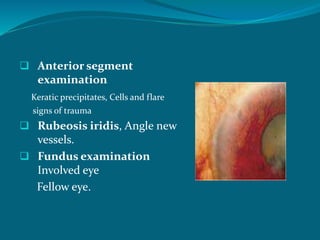  Anterior segment
examination
Keratic precipitates, Cells and flare
signs of trauma
 Rubeosis iridis, Angle new
vessels.
 Fundus examination
Involved eye
Fellow eye.
 