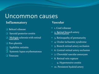 Uncommon causes
Inflammatory
 Behcet’s disease
 Sarcoid posterior uveitis
 Multiple sclerosis with retinal
vasculitis
 Pars planitis
 Syphilitic retinitis

 Systemic lupus erythematosus
 Toxocara
Vascular
 1. Coat’s disease
 2. Retinal branch artery
malformation
 3. Retinopathy of prematurity
 4. Ocular ischaemic syndrome
 5. Branch retinal artery occlusion
 6. Central retinal artery occlusion
 7. Choroidal vascular aneurysm
 8. Retinal vein rupture
. 9. Hypertensive uveitis
 10. Persistent hyaloid artery
 
