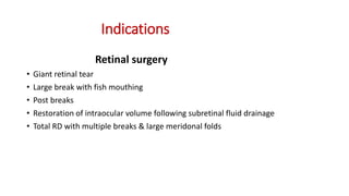 Indications
Retinal surgery
• Giant retinal tear
• Large break with fish mouthing
• Post breaks
• Restoration of intraocular volume following subretinal fluid drainage
• Total RD with multiple breaks & large meridonal folds
 