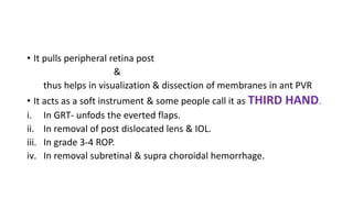 • It pulls peripheral retina post
&
thus helps in visualization & dissection of membranes in ant PVR
• It acts as a soft instrument & some people call it as THIRD HAND.
i. In GRT- unfods the everted flaps.
ii. In removal of post dislocated lens & IOL.
iii. In grade 3-4 ROP.
iv. In removal subretinal & supra choroidal hemorrhage.
 
