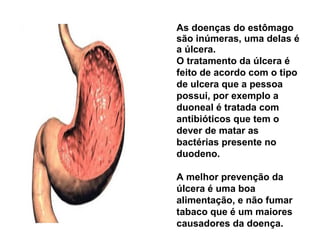 As doenças do estômago 
são inúmeras, uma delas é 
a úlcera. 
O tratamento da úlcera é 
feito de acordo com o tipo 
de ulcera que a pessoa 
possui, por exemplo a 
duoneal é tratada com 
antibióticos que tem o 
dever de matar as 
bactérias presente no 
duodeno. 
A melhor prevenção da 
úlcera é uma boa 
alimentação, e não fumar 
tabaco que é um maiores 
causadores da doença. 
 