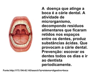 A doença que atinge a 
boca é a cárie dental. A 
atividade de 
microrganismo, 
decompondo resíduos 
alimentares que ficaram 
retidos nos espaços 
entre os dentes, produz 
substâncias ácidas. Que 
provocam a cárie dental. 
Prevenção: escovar os 
dentes todos os dias e ir 
ao dentista 
periodicamente. 
Fonte:http://173.194.42.143/search?q=sistema+digestivo+boca 
 