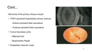 Pphpv Eye Vitrous anatomy and Physiology of the eye.pptx