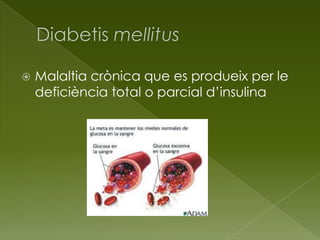  Malaltia crònica que es produeix per le
deficiència total o parcial d’insulina
 