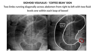 X-ray Reading Guide for UG MBBS students VIVA X-RAYS.pptx