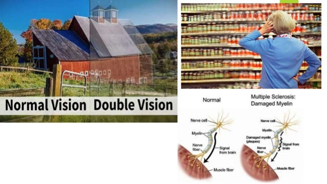 comprehensive low vision lighthouse near visual acuity chart