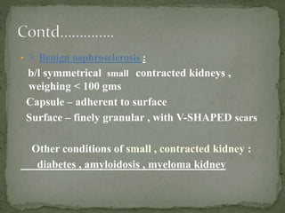• 3. Benign nephrosclerosis :
b/l symmetrical small contracted kidneys ,
weighing < 100 gms
Capsule – adherent to surface
Surface – finely granular , with V-SHAPED scars
Other conditions of small , contracted kidney :
diabetes , amyloidosis , myeloma kidney
 