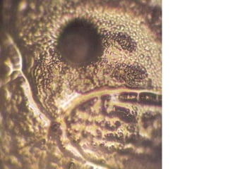 Rio Yodo
Osaka-JA
Água contaminada
 