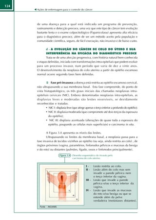 124
      Ações de enfermagem para o controle do câncer




      de uma doença para a qual está indicado um programa de prevenção,
      rastreamento e detecção precoce, uma vez que este tipo de câncer tem evolução
      bastante lenta e o exame colpocitológico (Papanicolaou) apresenta alta eficácia
      para o diagnóstico precoce, além de ser um método aceito pela população e
      comunidade científica, seguro, de fácil execução, não invasivo e de baixo custo.

             d - A EVOLUÇÃO DO CÂNCER DE COLO DO ÚTERO E SUA
             INTERFERÊNCIA NA EFICÁCIA DO DIAGNÓSTICO PRECOCE
             Trata-se de uma afecção progressiva, com história natural bem conhecida
      e etapas definidas, iniciada com transformações intra-epiteliais que podem evoluir
      para um processo invasor, num período que varia de dez a vinte anos.
      O desenvolvimento da neoplasia do colo uterino a partir do epitélio escamoso
      normal ocorre seguindo fases bem definidas.

                  Fase pré-invasora: a doença está restrita ao epitélio escamoso cervical,
      não ultrapassando a sua membrana basal. Esta fase compreende, do ponto de
      vista histopatológico, os três graus iniciais das chamadas neoplasias intra-
      epiteliais cervicais (NIC). Embora denominadas neoplasias intra-epiteliais, as
      displasias leves e moderadas são lesões reversíveis, se devidamente
      reconhecidas e tratadas.
              • NIC I : displasia leve (que atinge apenas o terço inferior a profundo do epitélio);
              • NIC II: displasia moderada (que compromete até dois terços da espessura
                do epitélio);
              • NIC III: displasia acentuada (alterações de quase toda a espessura do
                epitélio, poupando as células mais superficiais) e carcinoma in situ.

              A Figura 3.4 apresenta os níveis das lesões.
              Ultrapassando os limites da membrana basal, a neoplasia passa para a
      fase invasiva de tecidos vizinhos ao epitélio (ou seja, ainda restrita ao colo) , de
      órgãos próximos (vagina, paramétrios, linfonodos pélvicos e mucosas da bexiga
      e do reto) ou distantes (pulmões, fígado, ossos e linfonodos principalmente).
                           Figura 3.4 - Desenho esquemático da invasão pelo
                                        carcinoma do colo uterino.


                                                   I-    Lesão restrita ao colo.
                                                   II -  Lesão além do colo mas sem
                                                         invadir a parede pélvica nem
                                                         o terço inferior da vagina.
                                                   III - Lesão que invade a parede
                                                         pélvica e/ou o terço inferior da
                                                         vagina.
                                                   IV - Lesão que invade as mucosas
                                                         do reto e/ou bexiga ou que se
                                                         estende além da pelve
                                                         verdadeira (metástases distantes).

        Fonte : INCA/MS.
 