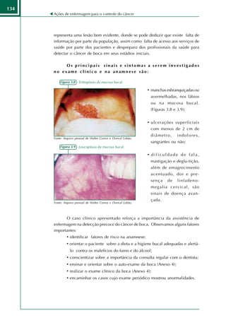 134
      Ações de enfermagem para o controle do câncer




      representa uma lesão bem evidente, donde se pode deduzir que existe falta de
      informação por parte da população, assim como falta de acesso aos serviços de
      saúde por parte dos pacientes e despreparo dos profissionais da saúde para
      detectar o câncer de boca em seus estádios iniciais.

           Os principais sinais e sintomas a serem investigados
      no exame clínico e na anamnese são:

          Figura 3.8 - Eritroplasia da mucosa bucal.

                                                                 • manchas esbranquiçadas ou
                                                                  avermelhadas, nos lábios
                                                                  ou na mucosa bucal.
                                                                  (Figuras 3.8 e 3.9);


                                                                 • ulcerações superficiais
                                                                  com menos de 2 cm de
                                                                  diâmetro,      indolores,
      Fonte: Arquivo pessoal de Walter Correa e Dorival Lobão.
                                                                  sangrantes ou não;
          Figura 3.9 -Leucoplasia da mucosa bucal.

                                                                 • dificuldade de fala,
                                                                  mastigação e deglu-tição,
                                                                  além de emagrecimento
                                                                  acentuado, dor e pre-
                                                                  sença    de    linfadeno-
                                                                  megalia cervical, são
                                                                  sinais de doença avan-
                                                                  çada.
      Fonte: Arquivo pessoal de Walter Correa e Dorival Lobão.




            O caso clínico apresentado reforça a importância da assistência de
      enfermagem na detecção precoce do câncer de boca. Observamos alguns fatores
      importantes:
               • identificar fatores de risco na anamnese;
               • orientar o paciente sobre a dieta e a higiene bucal adequadas e alertá-
                   lo contra os malefícios do fumo e do álcool;
               •   conscientizar sobre a importância da consulta regular com o dentista;
               •   ensinar e orientar sobre o auto-exame da boca (Anexo 4);
               •   realizar o exame clínico da boca (Anexo 4);
               •   encaminhar os casos cujo exame periódico mostrou anormalidades.
 