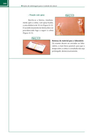 344
      Ações de enfermagem para o controle do câncer




             - Fixação com spray                             Figura A.12


             Borrifa-se a lâmina, imediata-
      mente após a coleta, com spray fixador,
      a uma distância de 10 cm (Figura A.12).
      O acondicionamento da lâmina deve ser
      providenciado logo a seguir à coleta
      (Figura A.13).

                  Figura A.13
                                            Remessa do material para o laboratório
                                            Os exames devem ser enviados ao labo-
                                            ratório, o mais breve possível, para que o
                                            tempo entre a coleta e o resultado não seja
                                            prolongado desnecessariamente.
 