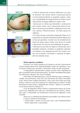 370
                           Ações de enfermagem para o controle do câncer




                     Figura A.20                  • observar alteração dos contornos abdominais, nos casos
                                                  de distensão. Nos clientes obesos a demarcação deverá
                                                  ser feita preferencialmente no quadrante superior, contar
                                                  com a possibilidade de emagrecimento do cliente e futuro
                                                  aparecimento de pregas abdominais (Figura A.20);
                                                  • atentar para os clientes que demandam a confecção de
                                                  dois estomas. Nestes casos a demarcação deverá ter dis-
                                                  tância suficiente para possibilitar a adaptação de dois siste-
      Fonte: Arquivo pessoal de Edjane Faria de   mas coletores. Preferencialmente em lados opostos do
             Amorim.
                                                  abdômen;
                                                  • ter ciência de que os pacientes emagrecidos (Figura A.21)
                     Figura A.21                  ou pacientes com doenças inflamatórias podem adquirir peso
                                                  na fase pós-operatória, correndo risco de afundamento do
                                                  estoma em prega cutânea. Nestes casos devem ser evitada
                                                  a demarcação nas áreas de maior deposição de gordura;
                                                  • saber que nos pacientes em urgência a demarcação não é
                                                  prioridade; entretanto, considerar os quadrantes superiores
                                                  com distância mais adequada possível das incisões, trau-
                                                  mas com lacerações, eviscerações e exposição de órgãos,
      Fonte: Arquivo pessoal de Edjane Faria de   além dos rebordos ósseos.
             Amorim.



                                  Outros aspectos a considerar
                                  Pacientes com história pregressa de alergia ou de pele extremamente
                           sensível poderão desenvolver hipersensibilidade à bolsa de colostomia e seus
                           acessórios, estando mais suscetível a desenvolver lesões da pele periestomal
                                  O desequilíbrio hidroeletrolítico poderá acarretar maior fragilidade da
                           pele e possibilitar lesões da pele periestomal. Pacientes imunodeprimidos pode-
                           rão desenvolver infecções com maior facilidade.
                                  Estes dados são importantes para a ação do enfermeiro que irá planejar o
                           cuidado. Este profissional, ciente dos riscos decorrentes dos dados assinalados
                           acima, deverá tomar medidas preventivas, assim como estar atento para diag-
                           nosticar e intervir o mais breve possível nas complicações do estoma e da pele
                           periestomal visando manter a integridade dos mesmos. Observe as característi-
                           cas de estoma normal no Quadro A.1.
                                  O uso de dispositivos (bolsa coletora) e equipamentos (placas de fixação
                           à pele) mais adequados para cada caso, manutenção da área adesiva, orienta-
                           ções sobre o autocuidado, são fundamentais nesta fase de adaptação à nova
                           realidade.
                                  Neste caso, as atribuições do Enfermeiro que trabalha com estomas seriam:
                                  • realizar consulta de enfermagem;
                                  • assistir/cuidar o cliente nas fases pré, trans e pós (imediata/mediata/
                                    tardia), objetivando o autocuidado;
 
