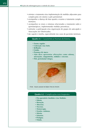 372
      Ações de enfermagem para o controle do câncer




             • orientar o tratamento e/ou implementação de medidas adjuvantes para
                 complicações em estoma e pele periestomal;
             •   acompanhar a doença de base quanto a exames e tratamento comple-
                 mentares;
             •   acompanhar os sinais e sintomas relacionados a tratamento radio e
                 quimioterápicos, implementando medidas preventivas;
             •   estimular a participação e/ou organização de grupos de auto-ajuda e
                 Associações de Ostomizados;
             •   dar suporte à família, especialmente nos casos de pacientes terminais.

                     Quadro A.1 - Características Normais do Estoma.

                      • Forma regular.
                      • Coloração rosa forte.
                      • Brilhante.
                      • Úmido.
                      • Presença de muco.
                      • Não deve apresentar alterações como edema,
                        ulcerações, sangramento, nódulos e necrose.
                      • Pele periestomal íntegra.




                  Fonte: Arquivo pessoal de Edjane Faria de Amorim.




                          Quadro A.2 - Complicações mais freqüentes.

                           •   Pós-operatório Imediato e/ou Mediato.
                           •   Edema.
                           •   Retração.
                           •   Abscesso.
                           •   Necrose.
                           •   Hemorragia.
                           •   Erosões cutâneas.
                           •   Hérnia.
                           •   Estenose.
                           •   Prolapso.
                           •   Fístula.
 