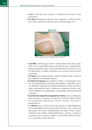 374
      Ações de enfermagem para o controle do câncer




             • O pó é indicado para aumentar a aderência do sistema à pele
               periestomal.
             • Os cintos utilizados para oferecer maior segurança ao cliente são fixa-
               dos à bolsa e presos ao redor da cintura, conforme Figura A.22.




                                             Figura A.22




                        Fonte: Arquivo pessoal de Edjane Faria de Amorim




             • A presilha é utilizada para fechar o sistema aberto. Este sistema apre-
               senta, na sua extremidade inferior, uma abertura que é mantida fecha-
               da por uma presilha. Após o esvaziamento da bolsa, esta deve ser lava-
               da internamente e fechada novamente com a presilha, para não haver
               vazamento.
             • O sistema para irrigação oferece conforto mediante ações mecânicas
               para regulação da atividade intestinal.
             • O sistema de irrigação para colostomia atende a uma população exclu-
               siva de colostomizados (colostomias descendente e sigmoideas), pois é
               um método de regulação da atividade intestinal por meios mecânicos,
               sendo contra-indicado para as ileostomias colostomias direitas, trans-
               versa de dupla boca e complicações, como prolapso, hérnia paraestomal
               e estenose.
             • O material dos dispositivos/equipamentos (bolsas), de um modo geral,
               deve apresentar as seguintes características: material plástico (opaco
               ou transparente), impermeável, flexível, antiodor, não tóxico e
               hipoalergênico.
             • Os adesivos para o sistema de uma peça devem ser hipoalergênicos e
               de alta adesividade à pele por pelo menos 24 horas. Para o sistema de
               duas peças, deve haver compatibilidade entre placa e bolsa, a placa
               contendo resina sintética (carboximetilcelulose + pectina + gelatina +
               excipiente) e para as bolsas urológicas, que tenham sistema anti-reflu-
               xo e mecanismo valvular de saída.
 