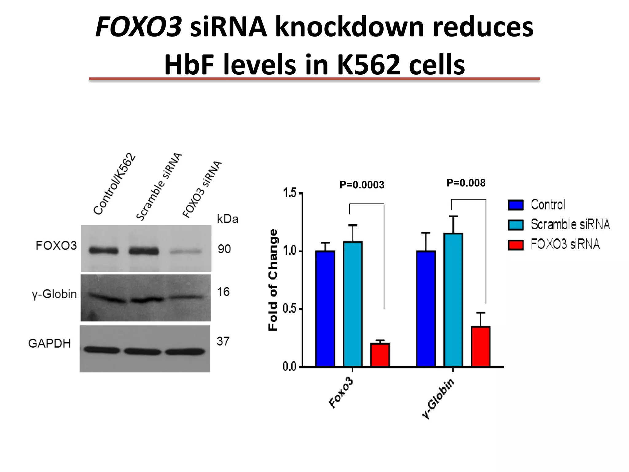 FOXO3 Regulates Fetal Hemoglobin Levels in Sickle Cell Anemia | PDF