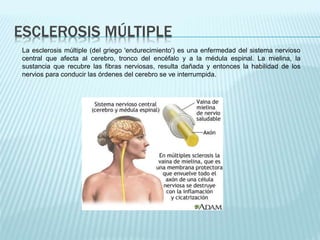 ESCLEROSIS MÚLTIPLE
La esclerosis múltiple (del griego 'endurecimiento') es una enfermedad del sistema nervioso
central que afecta al cerebro, tronco del encéfalo y a la médula espinal. La mielina, la
sustancia que recubre las fibras nerviosas, resulta dañada y entonces la habilidad de los
nervios para conducir las órdenes del cerebro se ve interrumpida.
 