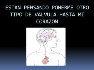 ESTAN PENSANDO PONERME OTRO
  TIPO DE VALVULA HASTA MI
          CORAZON
 