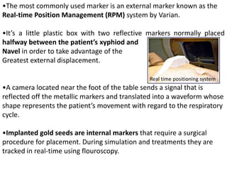 •The most commonly used marker is an external marker known as the
Real-time Position Management (RPM) system by Varian.
•It’s a little plastic box with two reflective markers normally placed
halfway between the patient’s xyphiod and
Navel in order to take advantage of the
Greatest external displacement.
•A camera located near the foot of the table sends a signal that is
reflected off the metallic markers and translated into a waveform whose
shape represents the patient’s movement with regard to the respiratory
cycle.
•Implanted gold seeds are internal markers that require a surgical
procedure for placement. During simulation and treatments they are
tracked in real-time using flouroscopy.
Real time positioning system
 