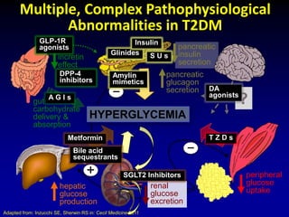 peripheral
glucose
uptake
hepatic
glucose
production
pancreatic
insulin
secretion
pancreatic
glucagon
secretion
gut
carbohydrate
delivery &
absorption
incretin
effect
HYPERGLYCEMIA
?
_
_
+
renal
glucose
excretion
DA
agonists
T Z D sMetformin
S U sGlinides
DPP-4
inhibitors
GLP-1R
agonists
A G I s
Amylin
mimetics
Insulin
Bile acid
sequestrants
SGLT2 Inhibitors
Multiple, Complex Pathophysiological
Abnormalities in T2DM
Adapted from: Inzucchi SE, Sherwin RS in: Cecil Medicine 2011
 