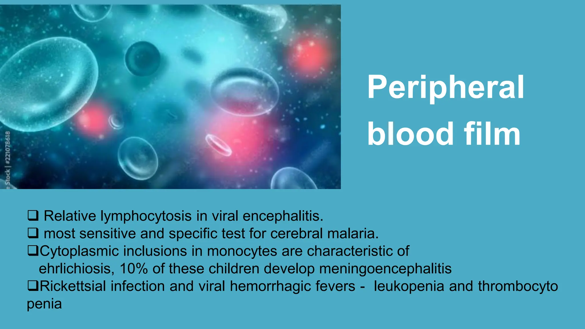 acute encephalitis syndrome | PPTX