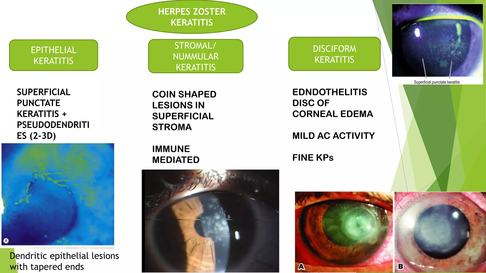 Viral Keratitis pdf