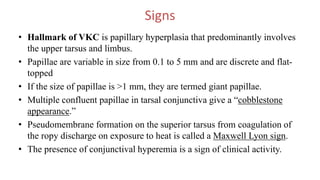 Signs
• Hallmark of VKC is papillary hyperplasia that predominantly involves
the upper tarsus and limbus.
• Papillae are variable in size from 0.1 to 5 mm and are discrete and flat-
topped
• If the size of papillae is >1 mm, they are termed giant papillae.
• Multiple confluent papillae in tarsal conjunctiva give a “cobblestone
appearance.”
• Pseudomembrane formation on the superior tarsus from coagulation of
the ropy discharge on exposure to heat is called a Maxwell Lyon sign.
• The presence of conjunctival hyperemia is a sign of clinical activity.
 